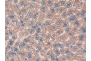 Detection of MUC1 in Mouse Liver Tissue using Polyclonal Antibody to Mucin 1 (MUC1)