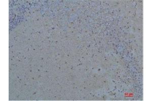 Immunohistochemistry (IHC) analysis of paraffin-embedded Rat Brain Tissue using S100 beta Rabbit Polyclonal Antibody diluted at 1:200. (S100B anticorps)