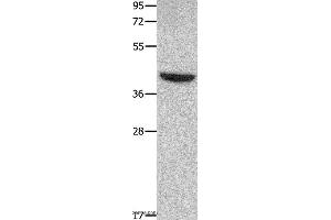 Western blot analysis of Mouse heart tissue, using MMP28 Polyclonal Antibody at dilution of 1:350