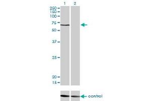 Western blot analysis of CACNB1 over-expressed 293 cell line, cotransfected with CACNB1 Validated Chimera RNAi (Lane 2) or non-transfected control (Lane 1). (CACNB1 anticorps  (AA 500-598))
