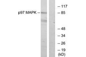 Western blot analysis of extracts from K562 cells, using p97 MAPK Antibody. (MAPK6 anticorps  (AA 461-510))