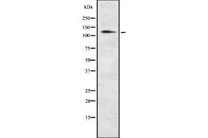 Western blot analysis of POM121 using NIH-3T3 whole cell lysates (POM121 anticorps)