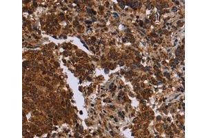 Immunohistochemistry (IHC) image for anti-Formin 2 (FMN2) antibody (ABIN2434662) (Formin 2 anticorps)