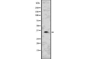 Western blot analysis of CNN1 using NIH-3T3 whole  lysates. (CNN1 anticorps  (N-Term))