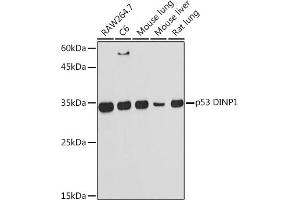 Western blot analysis of extracts of various cell lines, using p53 DINP1 Rabbit mAb (ABIN7271097) at 1:1000 dilution. (TP53INP1 anticorps)