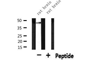 Western blot analysis of extracts from rat brain, using KAP2 Antibody.