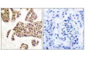 Immunohistochemistry (IHC) image for anti-BCL2-Associated Agonist of Cell Death (BAD) (pSer128), (pSer91) antibody (ABIN1847348) (BAD anticorps  (pSer91, pSer128))