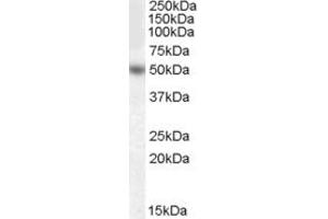 Western Blotting (WB) image for anti-Early Growth Response 4 (EGR4) (Internal Region) antibody (ABIN2465639) (EGR4 anticorps  (Internal Region))