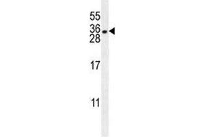 HLA-DQA1 antibody western blot analysis in NCI-H460 lysate. (HLA-DQA1 anticorps  (AA 39-66))