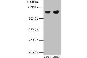 Western blot All lanes: PTPN6 antibody at 12 μg/mL Lane 1: Jurkat whole cell lysate Lane 2: Raji whole cell lysate Secondary Goat polyclonal to rabbit IgG at 1/10000 dilution Predicted band size: 68, 64, 71 kDa Observed band size: 68 kDa (SHP1 anticorps  (Isoform 2))