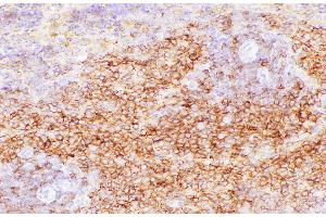 Immunohistochemistry of paraffin-embedded Rat spleen using CD38 Polycloanl Antibody at dilution of 1:200