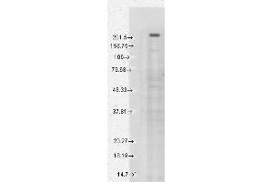 Western Blot analysis of Human Cell lysates showing detection of TrpM7 protein using Mouse Anti-TrpM7 Monoclonal Antibody, Clone S74 (ABIN361775).