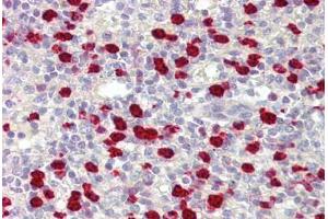 Anti-PARIS / ZNF746 antibody IHC staining of human spleen. (ZNF746 anticorps  (AA 395-444))