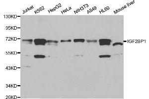 Western blot analysis of extracts of various cell lines, using IGF2BP1 antibody. (IGF2BP1 anticorps)