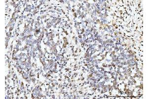IHC analysis of ARL6IP6 using anti-ARL6IP6 antibody (ABIN7603020).