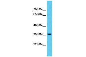Host: Rabbit Target Name: TTLL11 Sample Type: THP-1 Whole Cell lysates Antibody Dilution: 1. (TTLL11 anticorps  (N-Term))