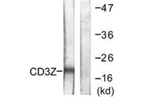 Western blot analysis of extracts from Jurkat cells, treated with UV 15', using CD3 zeta (Ab-42) Antibody. (CD247 anticorps  (AA 111-160))