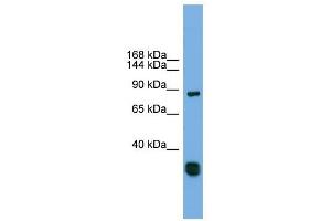 FSTL5 antibody used at 1 ug/ml to detect target protein. (FSTL5 anticorps  (Middle Region))