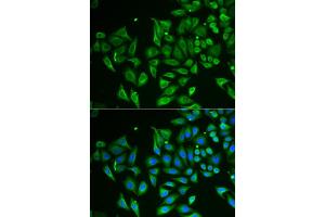 Immunofluorescence analysis of HeLa cells using CLEC3B/Tetranectin antibody (ABIN6130014, ABIN6138710, ABIN6138712 and ABIN6222056). (CLEC3B anticorps  (AA 22-202))