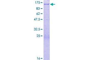 Image no. 1 for Peroxisomal Biogenesis Factor 6 (PEX6) (AA 1-980) protein (GST tag) (ABIN1314708)
