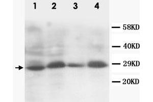 Western Blot analysis of SSX2 expression from cell extracts with SSX2 polyclonal antibody . (SSX2 anticorps  (C-Term))