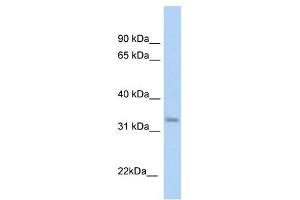 KHK antibody used at 1 ug/ml to detect target protein. (Ketohexokinase anticorps)