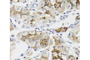 Immunohistochemistry of paraffin-embedded Human stomach using LFNG Polyclonal Antibody at dilution of 1:100 (40x lens). (LFNG anticorps)