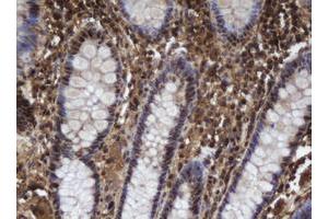 Image no. 1 for anti-Apurinic/Apyrimidinic Endonuclease 1 (APEX1) (AA 1-242) antibody (ABIN1490626)