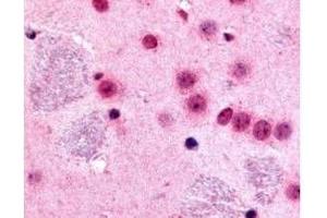 Affinity Purified anti-mouse Gli-2 antibody was used at 10 µg/ml to evaluate staining on several mouse tissues.