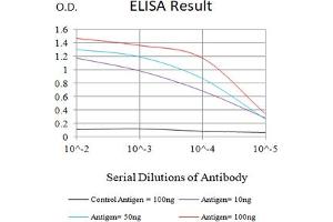 Black line: Control Antigen (100 ng),Purple line: Antigen (10 ng), Blue line: Antigen (50 ng), Red line:Antigen (100 ng) (Adenosine Triphosphate anticorps  (AA 44-220))