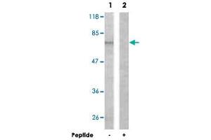 Western blot analysis of extracts from HUVEC cells, using ALOX5 polyclonal antibody . (ALOX5 anticorps)