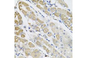 Immunohistochemistry of paraffin-embedded human stomach using SDC2 antibody at dilution of 1:100 (x40 lens). (Syndecan 2 anticorps)