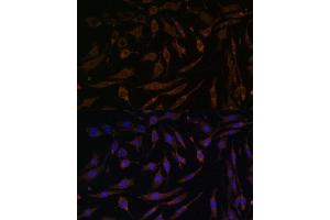 Immunofluorescence analysis of L929 cells using RPS6K antibody (5718) at dilution of 1:100. (RPS6KA1 anticorps  (C-Term))