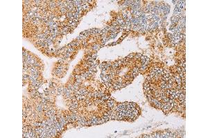 Immunohistochemistry (IHC) image for anti-Tyrosyl-tRNA Synthetase 2, Mitochondrial (YARS2) antibody (ABIN2422815) (YARS2 anticorps)