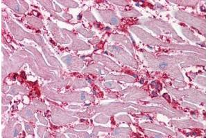 Human Heart: Formalin-Fixed, Paraffin-Embedded (FFPE)