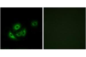 Immunofluorescence analysis of A549 cells, using MRPL11 Antibody. (MRPL11 anticorps  (AA 21-70))