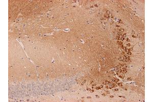 Indirect immunostaining of PFA fixed mouse brain section with anti-endophilin (dilution 1 : 200; red) and guinea pig anti-SV 2C (cat.