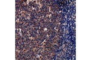 Immunohistochemical analysis of Tryptase delta staining in human tonsil formalin fixed paraffin embedded tissue section. (TPSD1 anticorps)