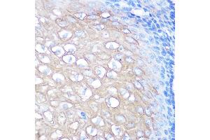 Immunohistochemistry of paraffin-embedded human esophageal using [KO Validated] CD168/RHAMM Rabbit mAb  at dilution of 1:100 (40x lens).