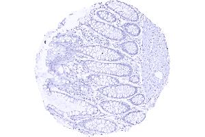 anti-Insulin (INS) antibody