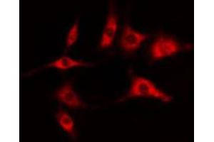 ABIN6274403 staining COLO205 cells by IF/ICC. (DOK6 anticorps  (Internal Region))
