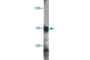 Western blot analysis of RC3H1 in HeLa cell lysate with RC3H1 polyclonal antibody  at 1 ug/mL. (RC3H1 anticorps  (AA 1040-1090))