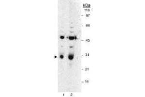 Western blot analysis of HPGD in LoVo whole cell lysates using HPGD polyclonal antibody . (HPGD anticorps)