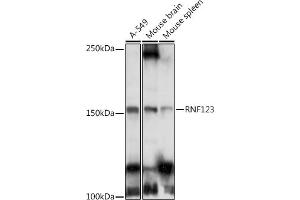 Western blot analysis of extracts of various cell lines, using RNF123 antibody (ABIN6129118, ABIN6147005, ABIN6147006 and ABIN6223534) at 1:1000 dilution. (RNF123 anticorps  (AA 1213-1314))