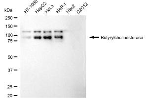 Western blotting analysis using Butyrylcholinesterase antibody (ABIN7797807).