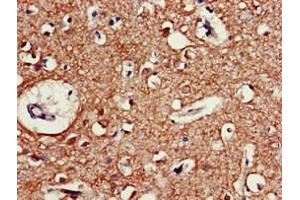 Immunohistochemistry of paraffin-embedded human brain tissue using ABIN7160353 at dilution of 1:100 (CHRM5 anticorps  (AA 220-427))