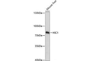 Western blot analysis of extracts of Mouse liver using HIC1 Polyclonal Antibody at dilution of 1:3000. (HIC1 anticorps)