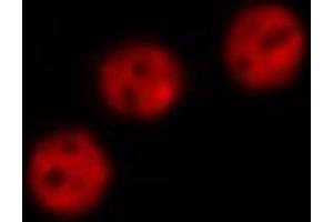 ABIN6274105 staining Hela by IF/ICC. (AKAP8 anticorps  (Internal Region))