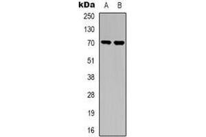 Western blot analysis of TGFBR2 expression in A549 (A), NIH3T3 (B) whole cell lysates. (TGFBR2 anticorps)