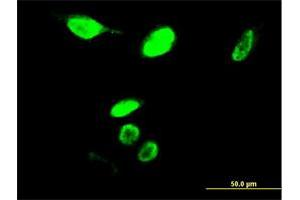 Immunofluorescence of monoclonal antibody to MYBL2 on HeLa cell. (MYBL2 anticorps  (AA 601-700))